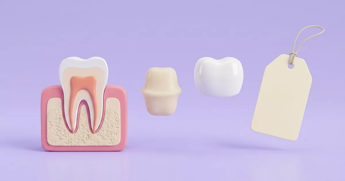 Ilustración de las partes que se cobran al salvar un diente: raíz con endodoncia, núcleo de resina y corona, junto a una etiqueta de precio